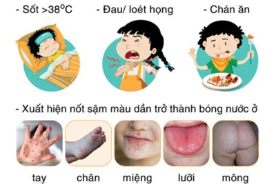 BÀI TUYÊN TRUYỀN PHÒNG BỆNH TAY CHÂN MIỆNG